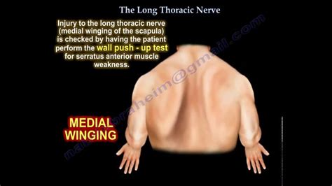 Long Thoracic Nerve Palsy - slidesharetrick