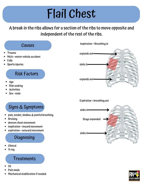 Flail Chest Nursing School Notes, Med Surg Pulmonary Basics, Flail ...