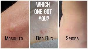 8 Differences Between Bed Bug Bites and Spider Bites with Table - Core ...