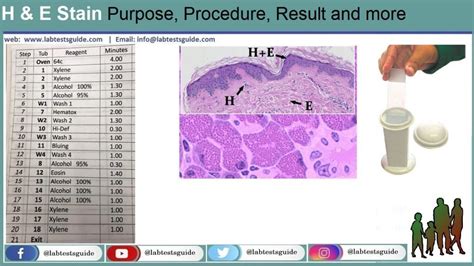 H&E Stain Purpose, Procedure, Result And More | Lab Tests Guide