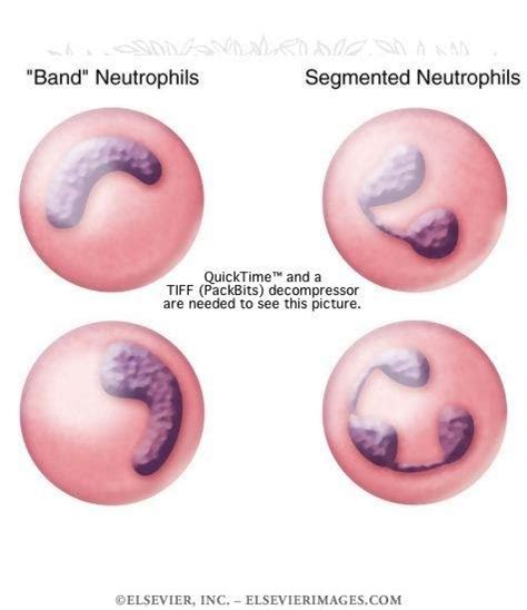 Band neutrophil or Staff Cell | Medical Laboratories