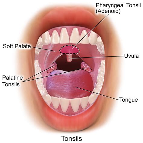 Tonsil Removal (Tonsillectomy)