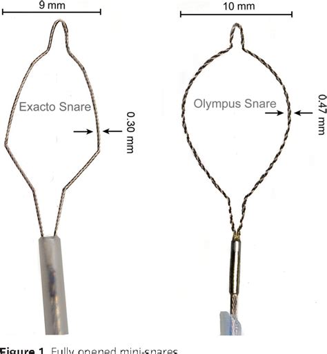 [PDF] Cold snare polypectomy: does snare type influence outcomes? | Semantic Scholar