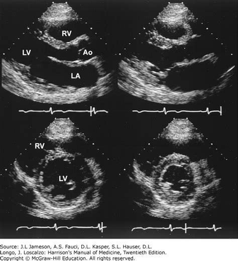 ECHOCARDIOGRAPHY | Harrison's Manual of Medicine