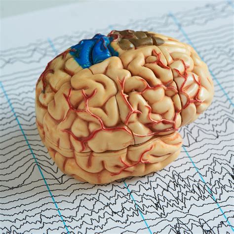 TBI Diagnosis and Treatment: A Vital Discussion