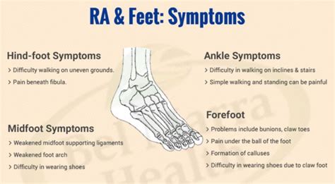 Rheumatoid arthritis and feet: The connection and feet arthritis pain ...