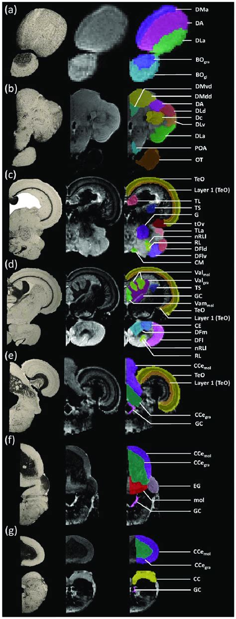 Comparison between Nissl stained histology sections (a) and MRI... | Download Scientific Diagram