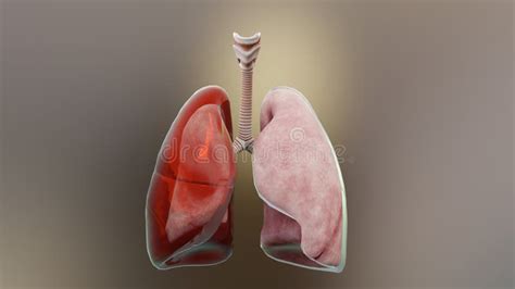 3d Illustration of Hemothorax, Normal Lung Versus Collapsed, Symptoms ...