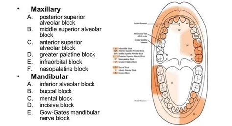 Dental Anesthesia Injection Sites Cheat Sheet - medicalkidunya