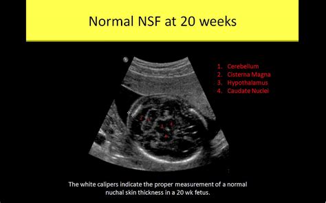 OB GYN Ultrasound Registry Review