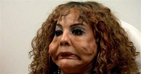 Trans woman who injected cement into face is unrecognisable after life-changing surgery - Daily Star