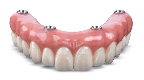 Zirconia Crown - BruxZir® Zirconia Crowns and Bridges