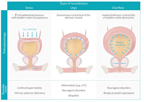 Detrusor Muscle