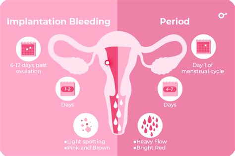 Menstrual Bleeding Vs Implantation Bleeding