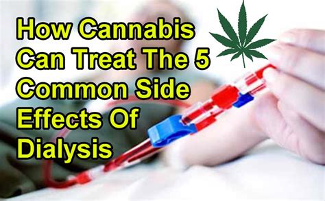 How Cannabis Can Treat The 5 Common Side Effects Of Dialysis