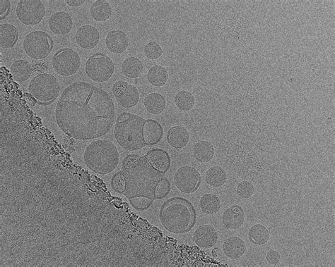 Lipid Nanoparticle characterization with cryo-TEM | Nano Imaging