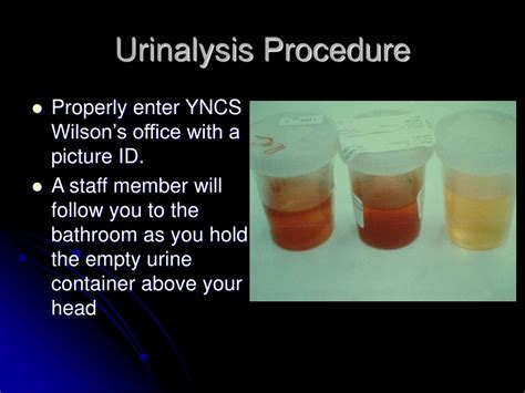 PPT - Urinalysis and Personal Accountability PowerPoint Presentation ...