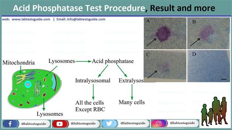 Acid Phosphatase Test Archives - Lab Tests Guide