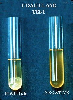 Coagulase Test: Principle, procedure and interpretation - Learn Microbiology Online