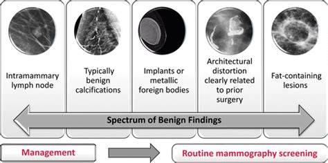 BI-RADS Terminology for Mammography Reports: What Residents Need to Know | RadioGraphics