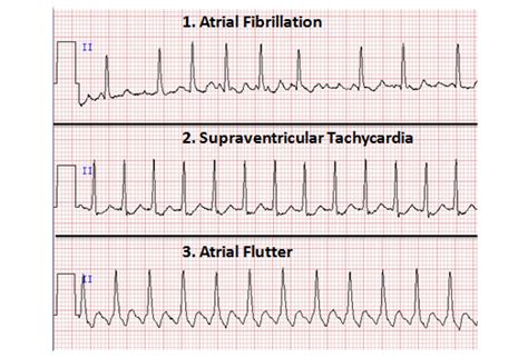 Arrhythmias_for_6_c..docx Arrhythmias_for_6_c..docx