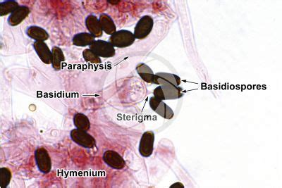 Basidia - Basidiomycota - Fungi - Plant histology - Photos