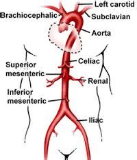 Learn exactly how to code CTA Abdominal Aorta with Runoff - Medical Coding Guide