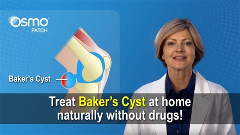 Baker's Cyst Treatment With Essential Oils - Quotes Marco