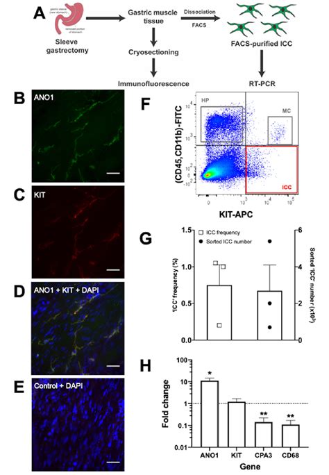 Identification and capture of candidate interstitial cells of Cajal ...