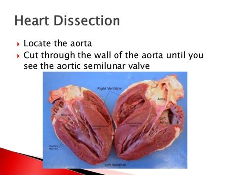 Mammal Heart Dissection