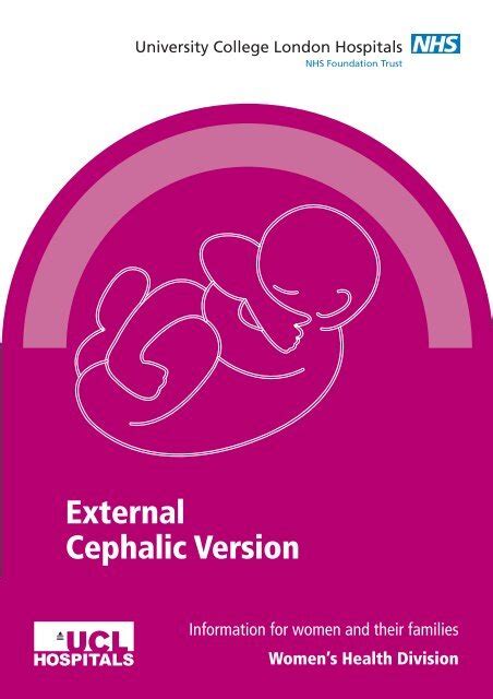 External Cephalic Version - University College London Hospitals