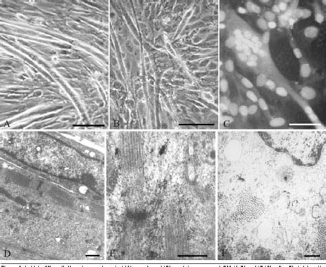 C2C12 murine myoblasts as a model of skeletal muscle development: morpho-functional ...