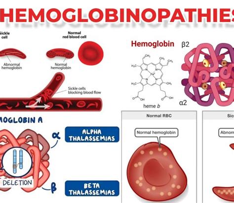 Hematology Archives - Medical Laboratory Scientist MLS