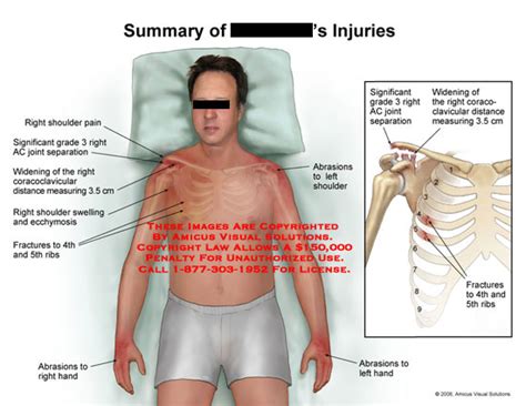 Summary of Injuries