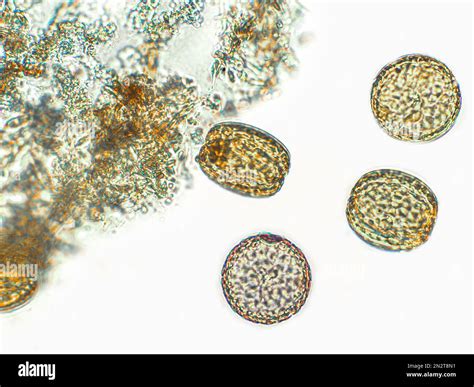 Diatoms, algae under microscopic view, phytoplankton, fossils, silica ...