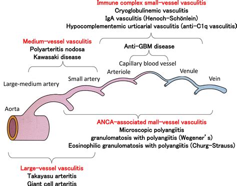 Outline of guidelines for the management of vasculitis and vascular ...