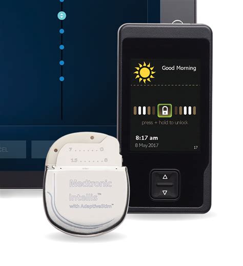 Medtronic Announces FDA Approval and U.S. Launch of Next Generation ...