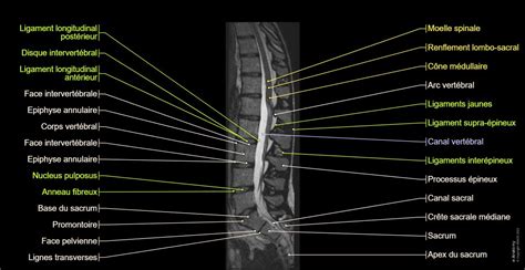 Rachis lombaire : anatomie normale | e-Anatomy