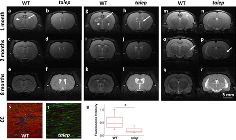 Frontiers | MRI Features in a Rat Model of H-ABC Tubulinopathy ...