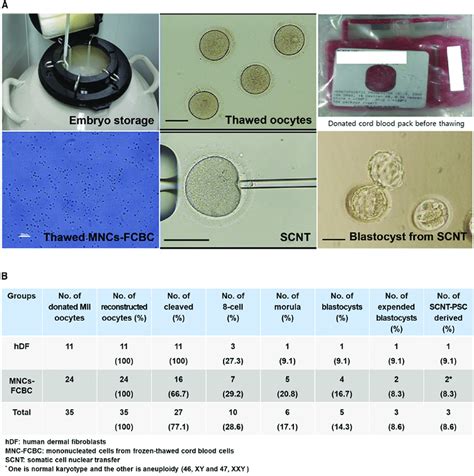 Human SCNT (A) Photographs of the SCNT procedure using cryopreserved ...