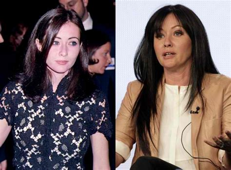 Shannen Doherty Plastic Surgery