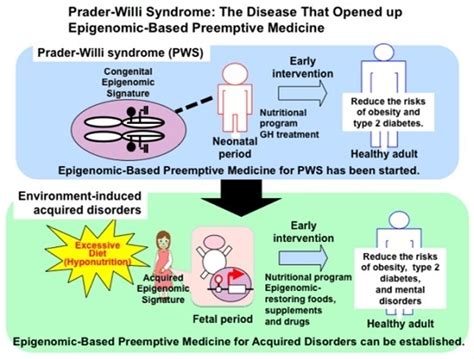 Prader Willi Syndrome Diet - Quotes Home