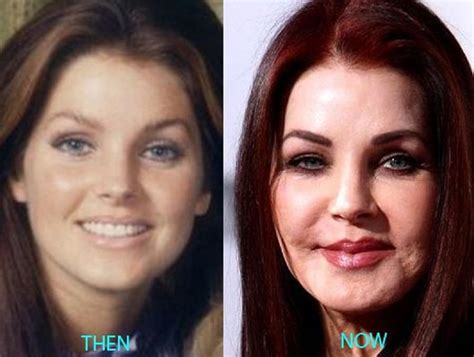 The Story of Priscilla Presley Plastic Surgery Disaster | Celebrity Plastic Surgery | Celebrity ...