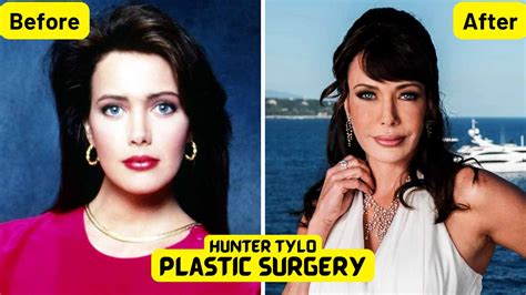 Hunter Tylo's plastic surgery - She looks completely different!