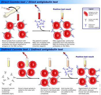 Coombs test - Wikipedia