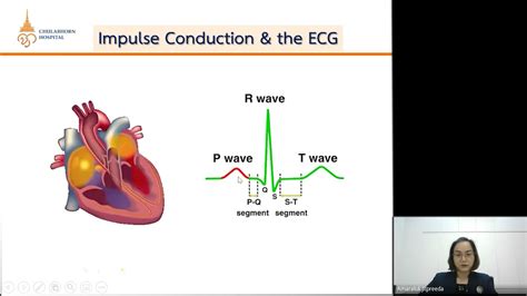 Basic ECG By Nurse - YouTube