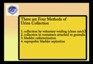 Pediatric Catheter Insertion in a baby girl : Free Download, Borrow, and Streaming : Internet ...