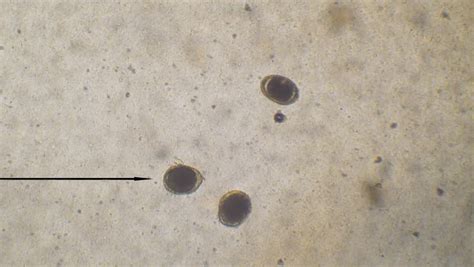 Veterinarian Looking At Roundworm Egg (Toxocara Canis) Under Microscope At 100x Magnification ...