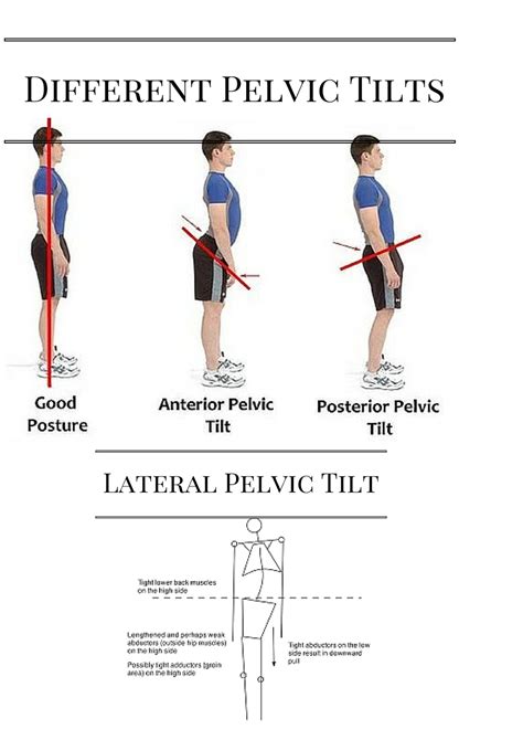 Anterior And Posterior Tilt Of Pelvis