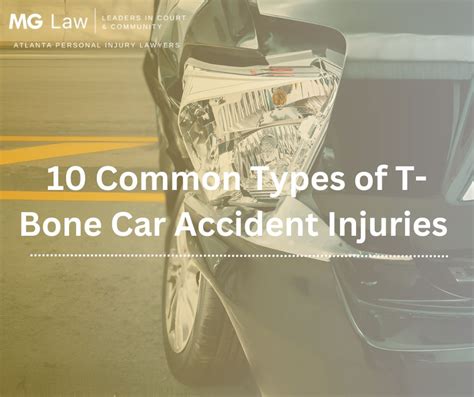 10 Common Types of T-Bone Car Accident Injuries - MG Law